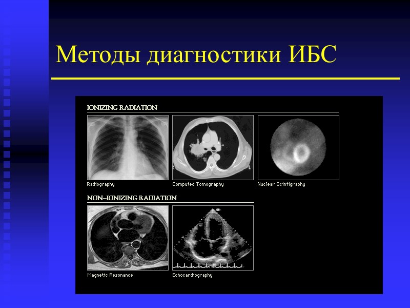 Методы диагностики ИБС